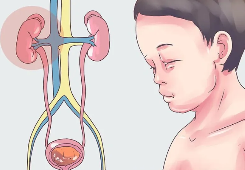 सूचना! माता-पिता को बच्चों में नेफ्रोटिक सिंड्रोम के 4 सामान्य लक्षणों के प्रति सचेत रहना चाहिए