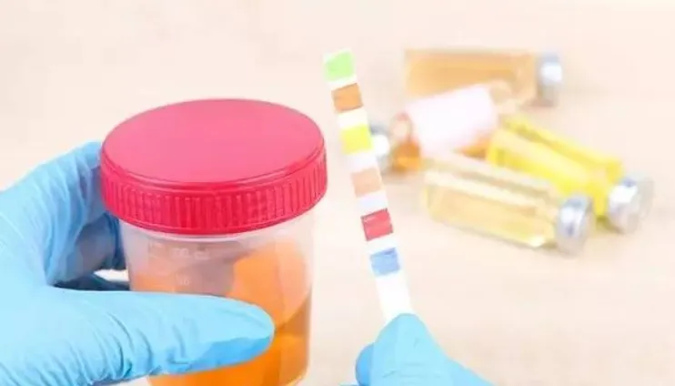 मूत्र के रंग और स्त्री रोग संबंधी रोगों के बीच क्या संबंध है?